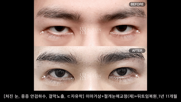 9c51a98e4c157229f09e5d92d92e6f45_1759367162_3101.gif