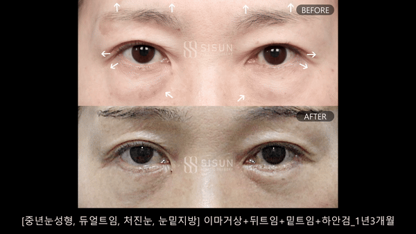9c51a98e4c157229f09e5d92d92e6f45_1759367167_7206.gif
