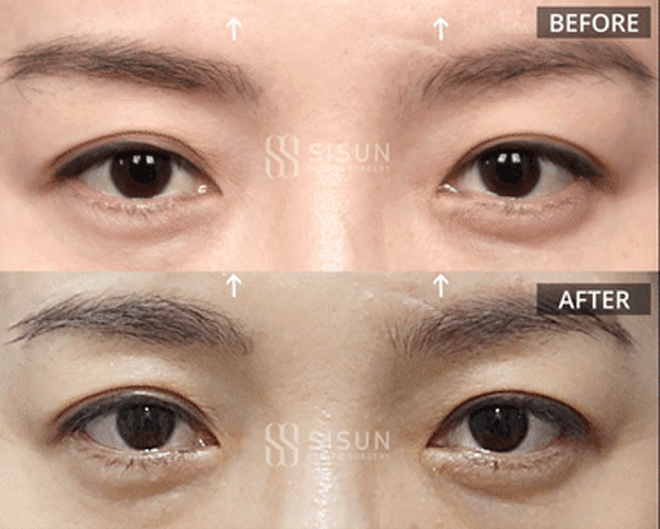 bb57526d9682692bc9c056479c45a1f3_1760948937_6645.gif