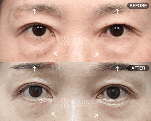 bb57526d9682692bc9c056479c45a1f3_1760948941_8257.gif