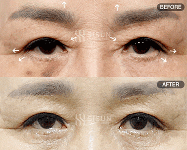 bb57526d9682692bc9c056479c45a1f3_1760948943_7803.gif
