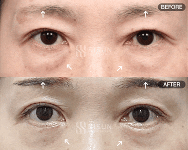 bb57526d9682692bc9c056479c45a1f3_1760949182_4298.gif