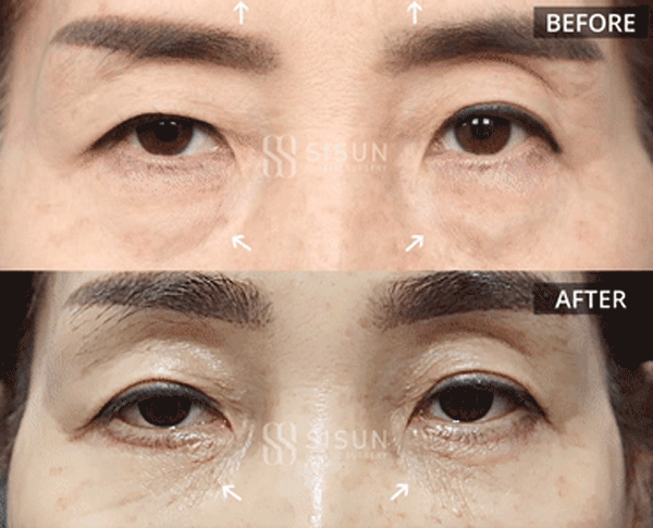 bb57526d9682692bc9c056479c45a1f3_1760949184_1171.gif