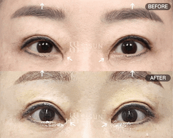 bb57526d9682692bc9c056479c45a1f3_1760949186_2562.gif