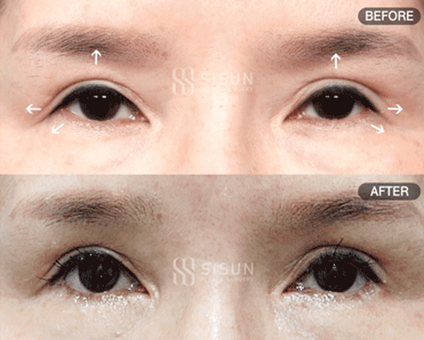 bb57526d9682692bc9c056479c45a1f3_1760949187_9875.gif
