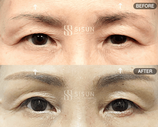 bb57526d9682692bc9c056479c45a1f3_1760949189_6645.gif