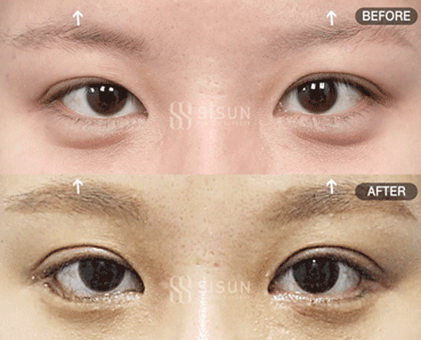 bb57526d9682692bc9c056479c45a1f3_1760949304_3167.gif