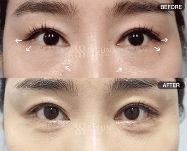 bb57526d9682692bc9c056479c45a1f3_1760949320_167.gif