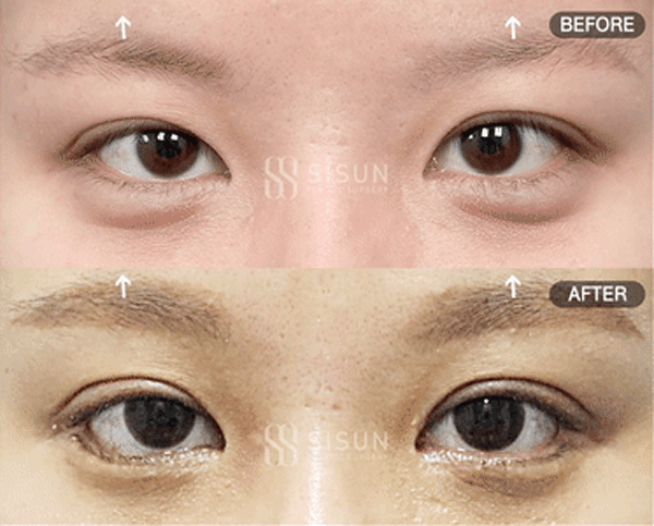 bb57526d9682692bc9c056479c45a1f3_1760949438_5046.gif