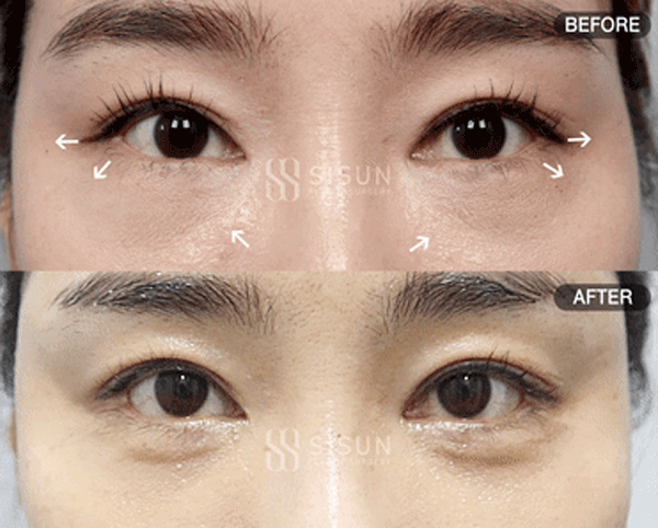 bb57526d9682692bc9c056479c45a1f3_1760949440_1738.gif