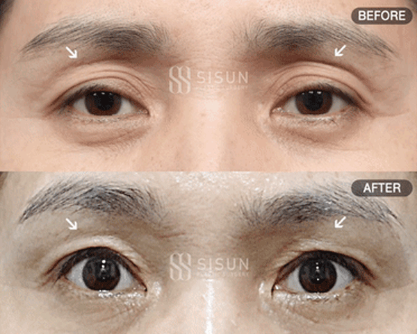 bb57526d9682692bc9c056479c45a1f3_1760949540_9777.gif