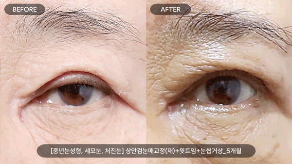 47cae13999f52a21c11d881a57307ed1_1778492293_7545.gif