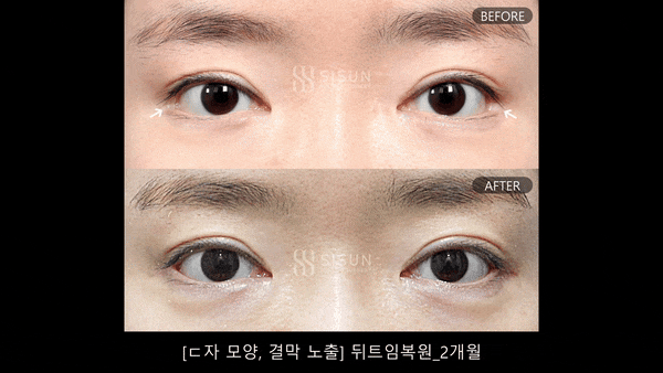 b213bc9e6c4b67c5d1329c9a082da415_1778143427_9528.gif