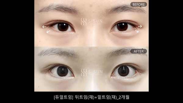 2a4c3879cef2144d8d6f87f0046770f2_1782465161_2413.gif