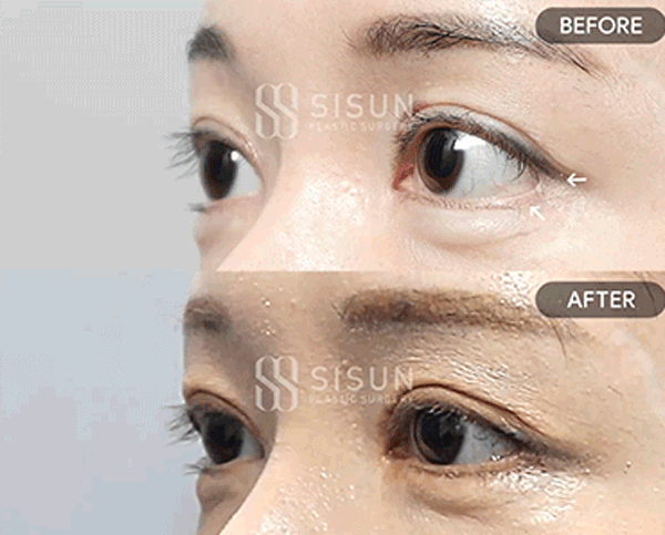eb6f3e8c035e46639a20a796a1ba472d_1782289489_4906.gif