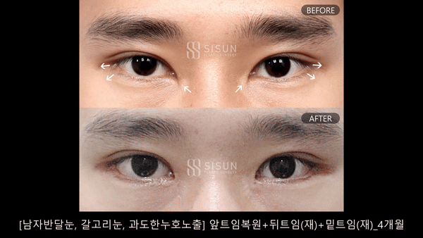 ebe094472e55e824eea5f02221a9d236_1782805151_4152.gif
