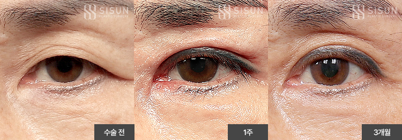 f75ae423efe8cf21c745dd17081bd5f6_1782120067_3632.jpg