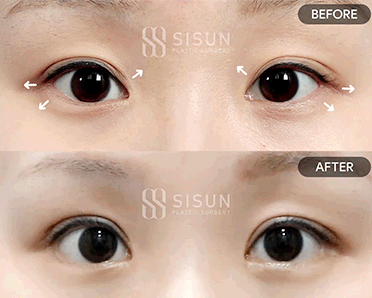 0616bedf13a7527a2cfb5fc822687372_1784539697_4043.gif