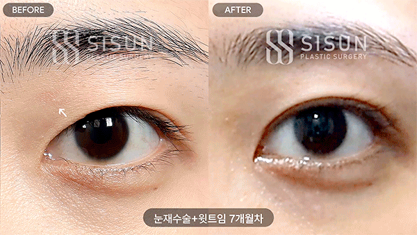 5d93b64ead51fb9a8193ab95b5a024a2_1784885945_6713.gif