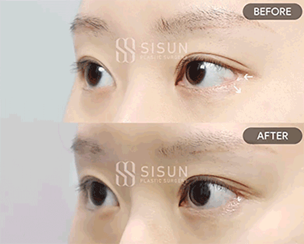 6711d7117fbb27ff2c1a861e5f36bc1f_1782897887_4703.gif