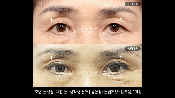 e53a1d664c3c466ee9a8b98dd9778ecc_1786353009_1158.gif