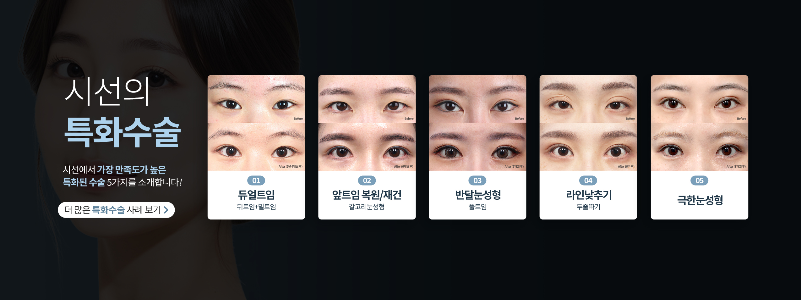 แบนเนอร์หลัก 3